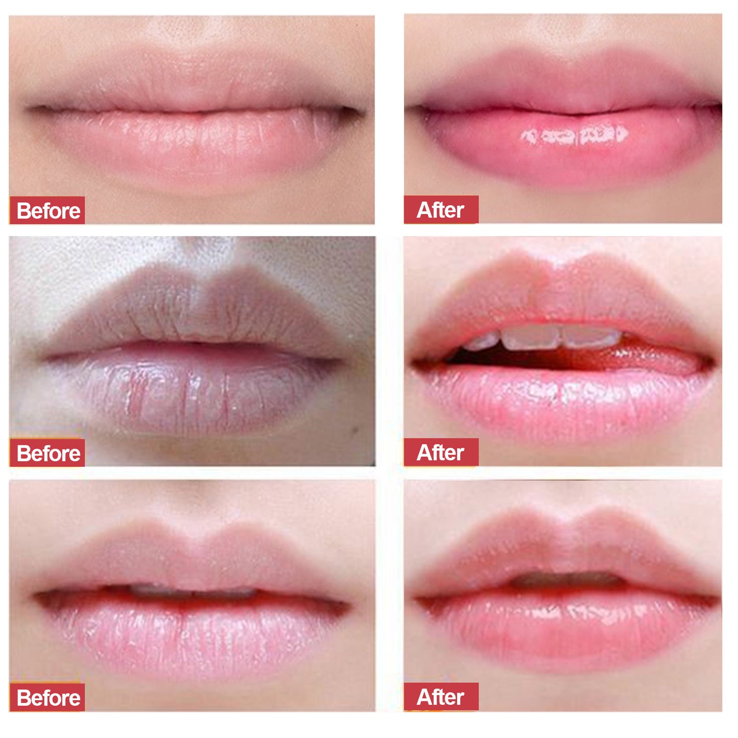 ELAIMEI - Lip Scrub Exfoliator and Moisturizer-Lip Repair for Chapped Dry Lips