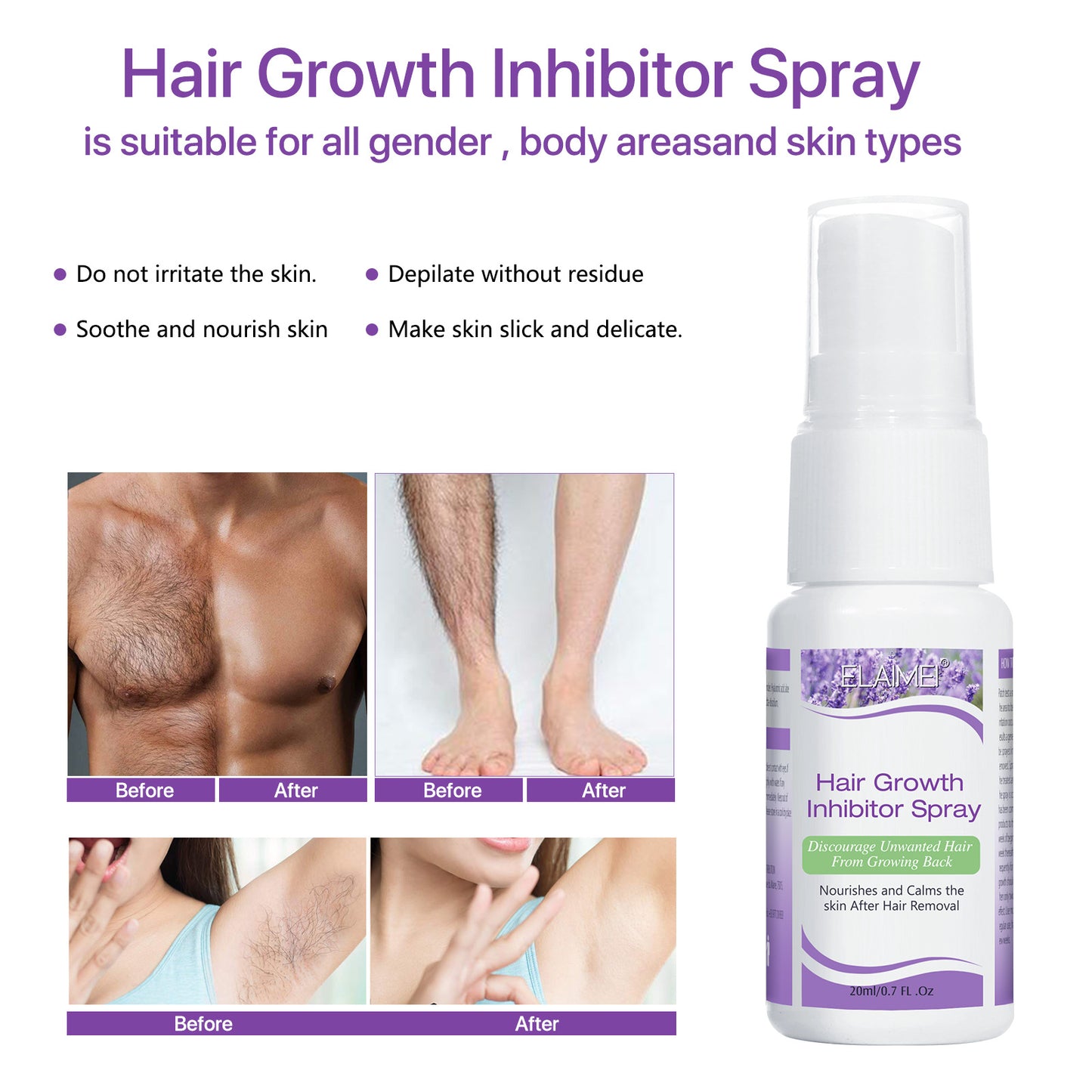 ELAIME - Hair Growth Inhibitor - Hair Stop Growth Spray - Hair Removal Spray