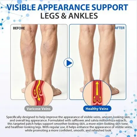 imgi_15_s-pdpxl.webp